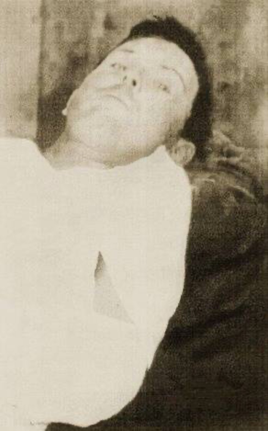Portrait photograph of Emmett Dalton, the sole surviving member of the Dalton Gang, photographed after his capture following the October 5, 1892 raid in Coffeyville, Kansas